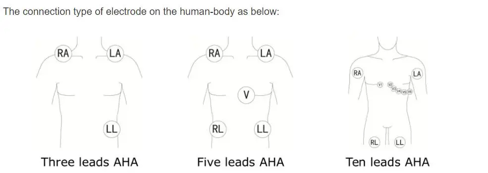 5-plom líquids ECG per a Philips digitrak més 24 hores 3100A, 5-plom, Snap